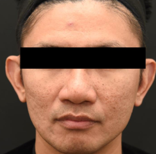 Before/After Image